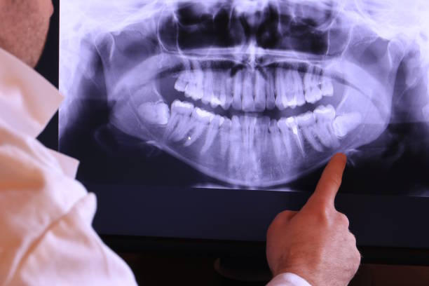 Best Emergency Root Canal Treatment in Skidway Lake, MI