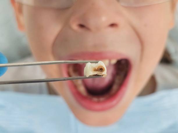 Best Orthodontic Emergency Dentist in Skidway Lake, MI