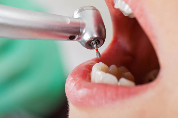 Best Emergency Dentist for Knocked-Out Tooth in Skidway Lake, MI